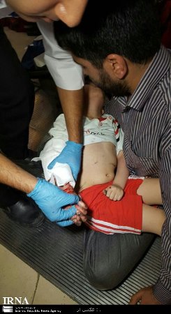 دست کودک مشهدی در پله برقی له شد