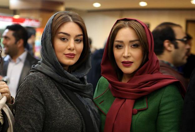 خانم بازیگر با دست و پای شکسته! +عکس