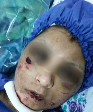شکنجه هولناک یک زن و دخترش توسط همسر +تصاویر