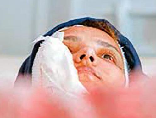گفتگو با زن جوان پس از حادثه‌ غیرقابل‌باور در مشهد +عکس