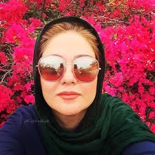 نخستین عکس بازیگر زن ایرانی بعد از عمل جراحی