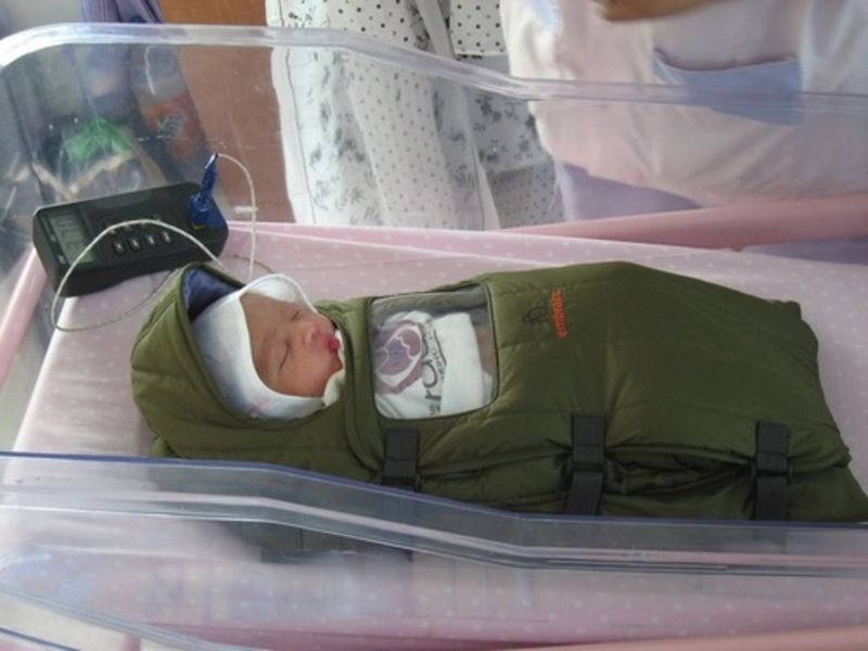 شایعترین علتهای مرگ نوزادان در ایران/ مرگ در کمین نوزادان نارس شایعترین علتهای مرگ نوزادان در ایران/ مرگ در کمین نوزادان نارس