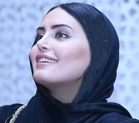کنایه الناز شاکردوست به مقصران مصدومیتش+ عکس