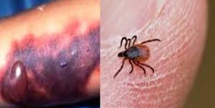 فوت شهروند گیلانی در اثر ابتلا به تب کریمه کنگو/۱۴ نفر در استان مبتلا شدند
