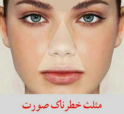 هرگز به جوشهای این قسمت از صورت دست نزنید! هرگز به جوشهای این قسمت از صورت دست نزنید!