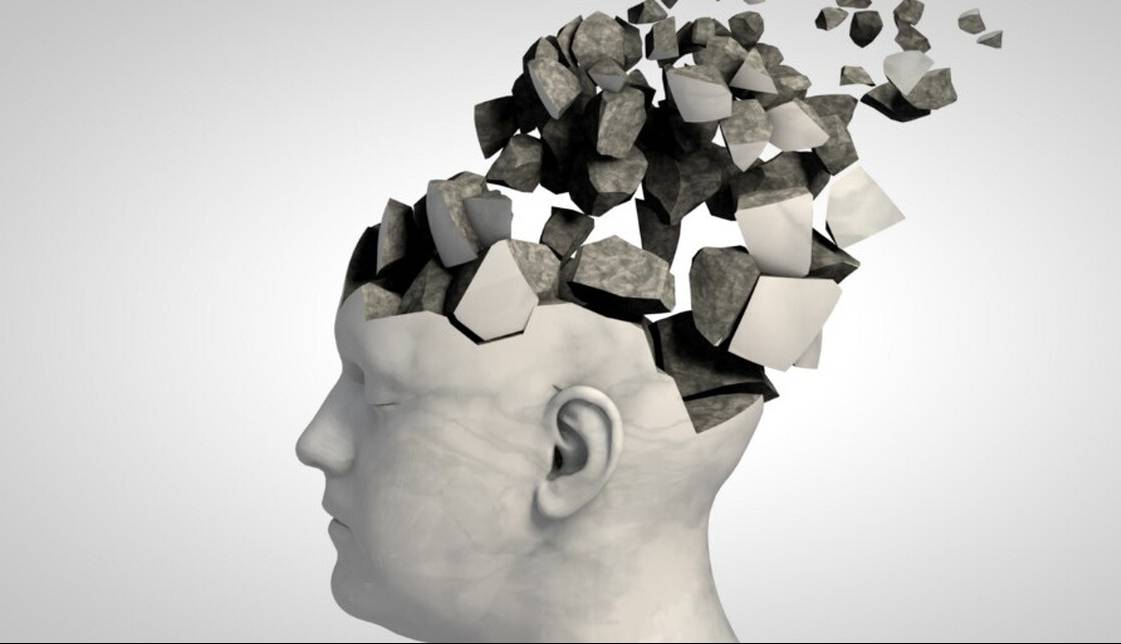 داروی جدیدی علایم آلزایمر را تا ۳۵ درصد کاهش دهد