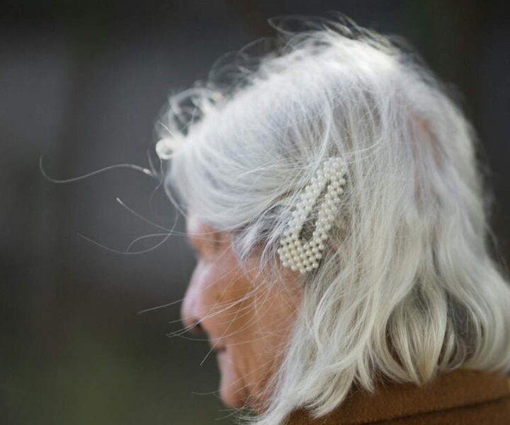 چینی‌ها روشی جدید برای درمان سفیدی موها معرفی کردند